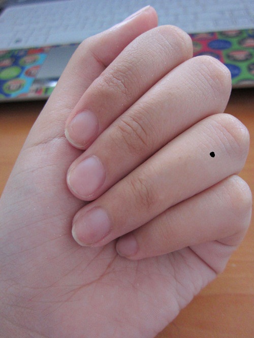 Ý nghĩa bất ngờ của những nốt ruồi trên ngón tay